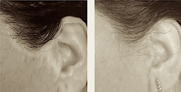 RECONSTRUCTIVA